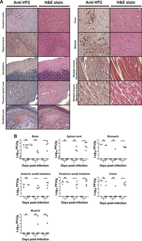 Replication Of Ev71 In Orally Infected Tg Mice A Histopathological