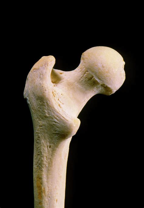 Head Of Human Femur Thigh Bone Photograph By James Stevensonscience