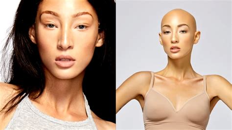 Watch Antm Contestant Diagnosed With Alopecia Declares Bald Is