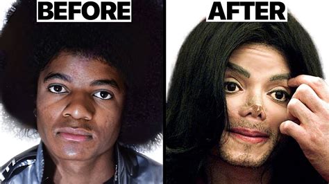 Michael Jackson Nose Job Plastic Surgeries Surgeon Reacts Accords Chordify