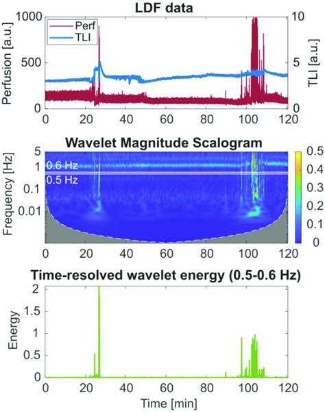 Wavelet Scalogram Of The Perfusion Signal And Time Resolved Wavelet