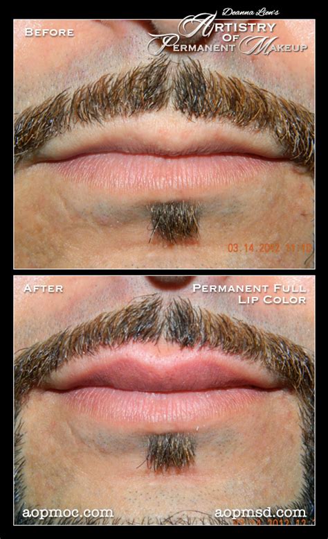 Artistry Of Permanent Makeup Permanent Lips Gallery Before And After
