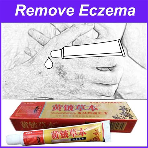 Купить Remove Rash Treatment Psoriasis Ointment Dermatitis Skin Eczema