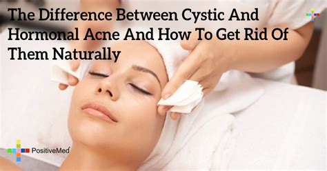The Difference Between Cystic And Hormonal Acne And How To Get Rid Of