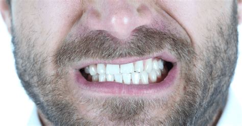 Can Teeth Grinding Cause Tinnitus Treble Health