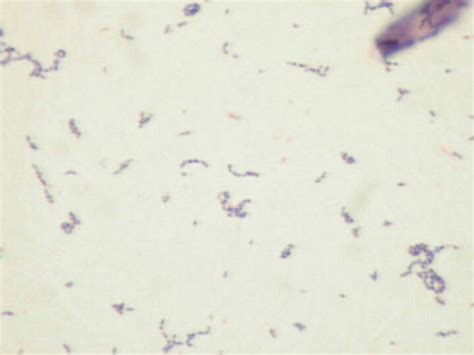 Name S Mutans Group Morphology Chains Or Short Rods Gram Stain