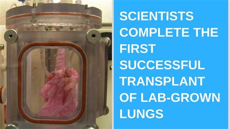 Scientists Complete The First Successful Transplant Of Lab Grown Lungs