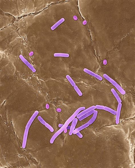 Bacillus Anthracis Photograph By Dennis Kunkel Microscopyscience Photo