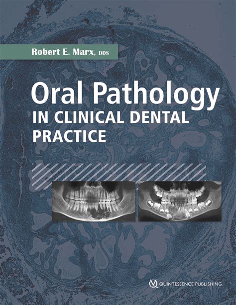 Oral Pathology In Clinical Dental Practice Dentalbookshop