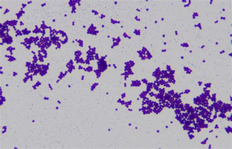 Staphylococcus Aureus Gram Stain Gram Stain Of Pure Cultur Flickr