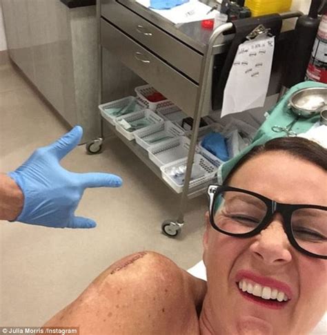 Im A Celebrity Host Julia Morris Issues Warning As She Has Skin Cancer