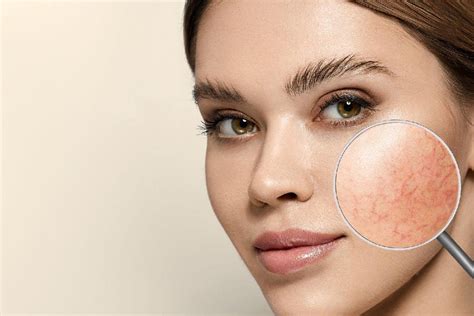 Dry Skin Causes Symptoms And Effective Remedies