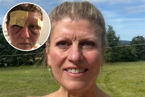 Colorado Woman Mauled by Bear as She Fixed Hot Tub in Backyard