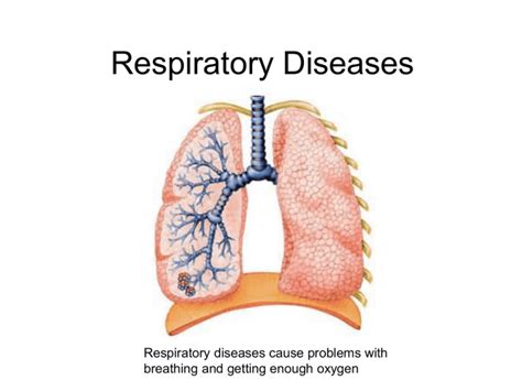 Three Main Types Of Lung Disease Powerpoint