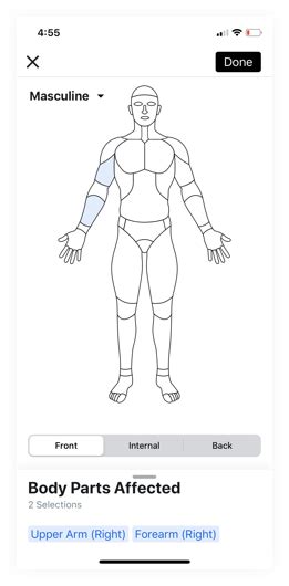 Incidents Body Parts Diagram Now Available On Mobile Procore En Gb