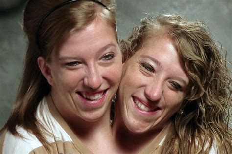 15 Facts About Conjoined Twins Abby And Brittany Hensel Conjoined