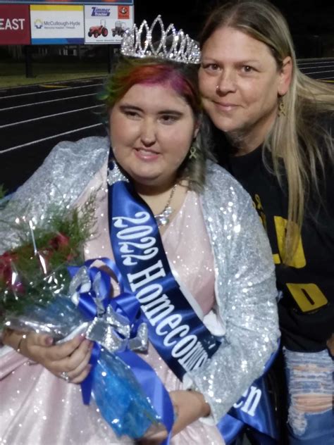 High School Senior Fighting Rare Brain Cancer Crowned Homecoming Queen