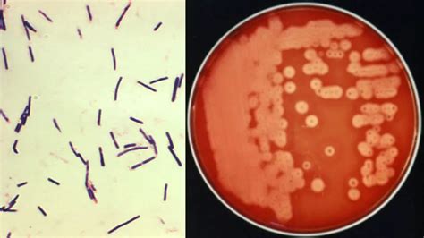Clostridium Perfringens Overview