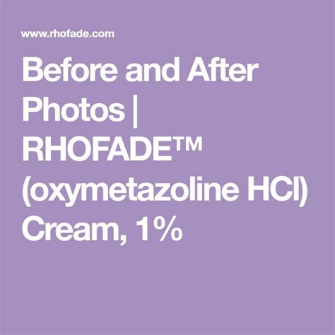 Before And After Photos Rhofade™ Oxymetazoline Hcl Cream 1