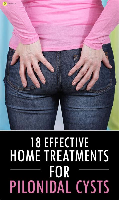 13 Pilonidal Cyst Home Treatments In 2020 Pilonidal Cyst Cysts Home Treatment