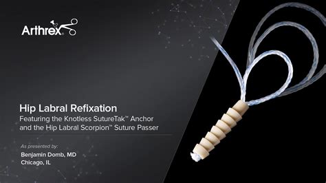 Arthrex Hip Labral Refixation Featuring The Knotless Suturetak® Anchor And Hip Labral Scorpion