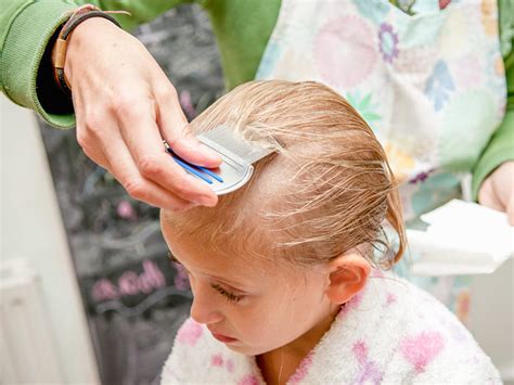 Head Lice Treatments Information That You Need To Know Health Promotion