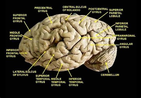 Gyrus Otak Korteks Serebral Dan Sulkus Neuroanatomi Anatomi Otak