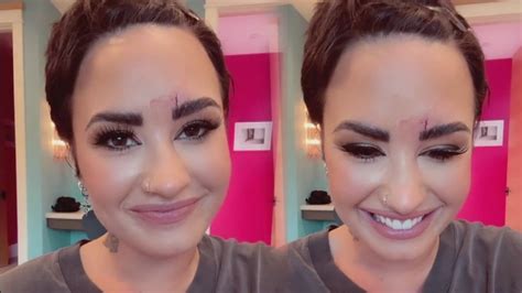 Demi Lovato Suffers Brutal Facial Injury Needs Stitches Ahead Of
