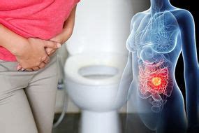 Bowel Cancer Warning The Pain In Your Back Passage You Should Never