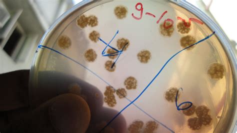 Pseudomonas Biofilm Extracted Cells Show A Very Typical Change In