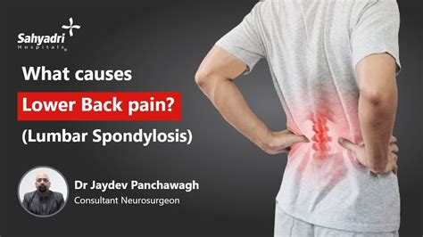 What Causes Lower Back Pain Treatment For Lumbar Spondylosis Dr
