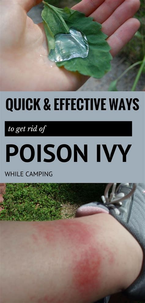 Quick And Effective Ways To Get Rid Of Poison Ivy While Camping