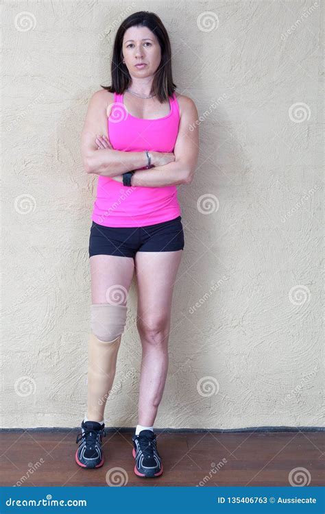 Mature Women With Below Knee Amuptation Stock Image Image Of Limb