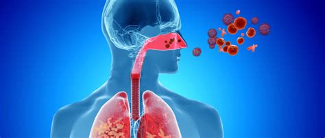 Enfermedades Del Sistema Respiratorio Causas Sintomas Y Tratamientos Images