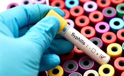 Sensitivity And Specificity Of 7 Treponemal Tests For Syphilis