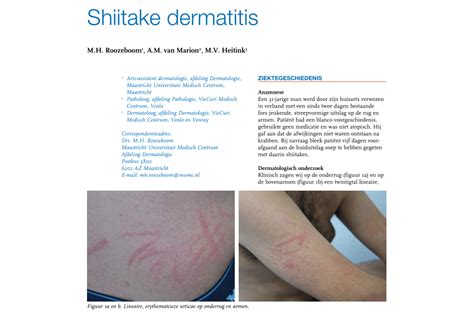 Pdf Shiitake Dermatitis