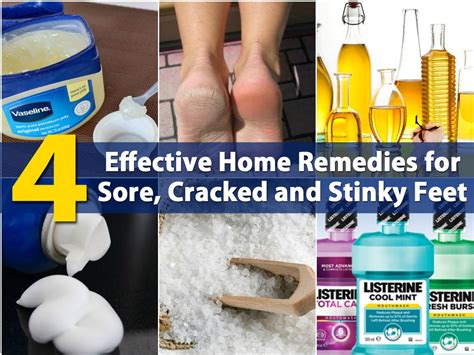 4 Effective Home Remedies For Sore Cracked And Stinky Feet Diy And Crafts