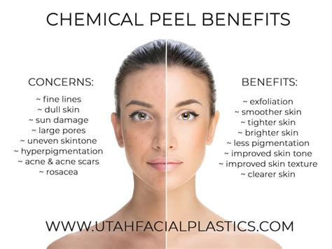 Before And After A Chemical Peel What To Expect Photos Artofit