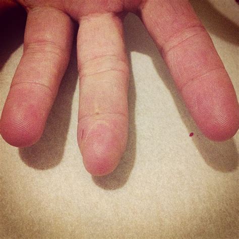 I Just Realised That My Friend S Finger Looks A Bit Like A Large