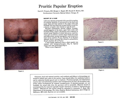 Pruritic Papular Eruption Jama Dermatology Jama Network