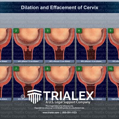 Extreme Cervix Insertion Search Xnxx Com Sexiezpix Web Porn