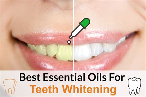 How To Whiten Teeth With Essential Oils Essential Oil Benefits