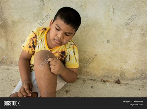 Little Boy Scratching Image And Photo Free Trial Bigstock