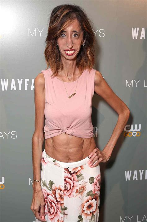 Lizzie Velasquez Responds To Unwillingly Becoming Face Of A Body