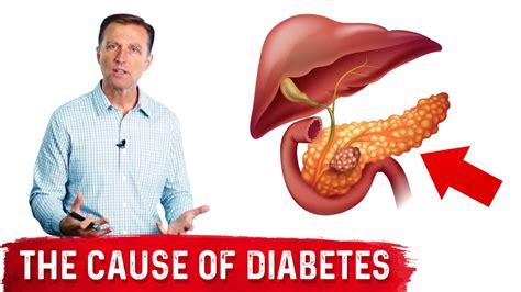 Your Fatty Pancreas Caused Your Diabetes YouTube