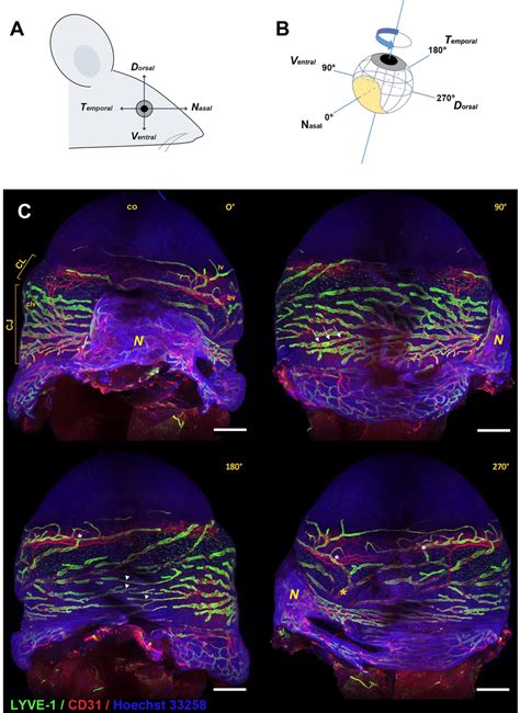 Right Eye Lymphatic Vessel Network Imaging By Light Sheet Fluorescence