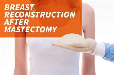 Breast Reconstruction After A Mastectomy The Surgery Group
