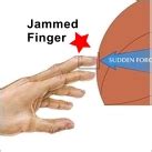 Below, you can learn how to tell if you have a jammed finger or if the injury might be more severe. Application Instructions | Athletic Tape Info Center
