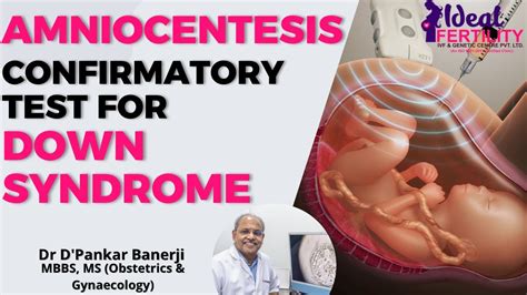 Amniocentesis Confirmatory Test For Down Syndrome Dr Dpankar