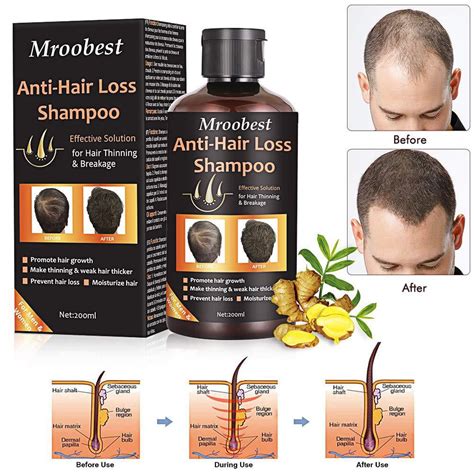 anti hair loss shampoo hair regrowth shampoo natural old ginger hair care shampoo effective